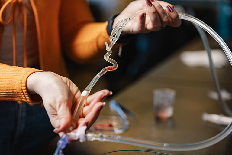 A resin model shows collateral blood flow.